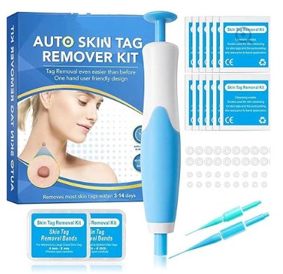 Acrochordon Skin Remover Kit